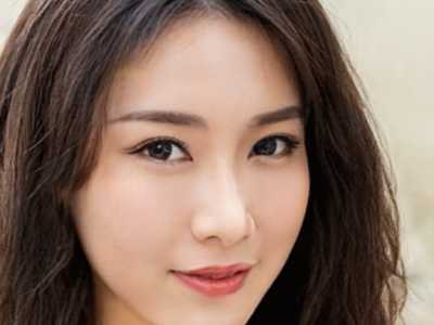 韩式自然双眼皮成形术有效果吗