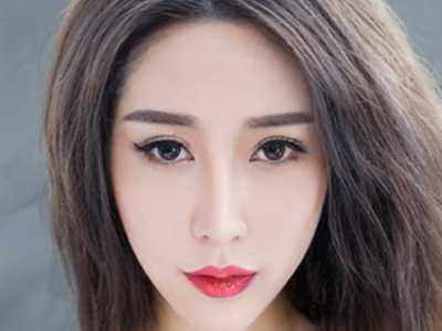 韩式小切口双眼皮疗效如何 令眼眸变漂亮